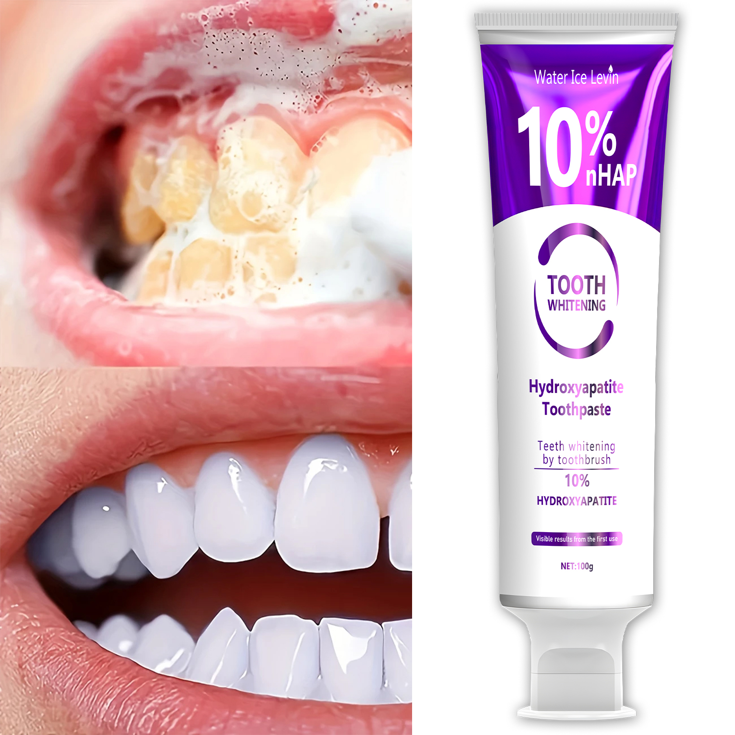 10% Nanoh Hydrogen Oxide Tooth - Teeth Whitening With Peroxide ulasan dan harga