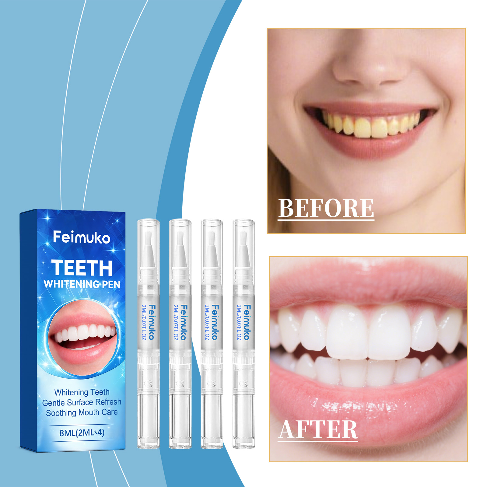 Feimuko 8ml Teeth Gel Pen Gent - Teeth Whitening Pen ulasan dan harga