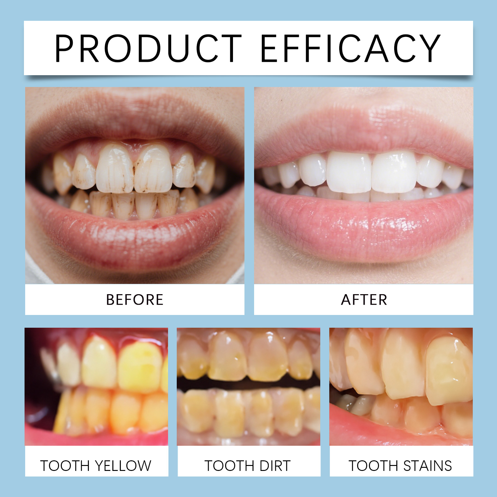Feimuko 8ml Teeth Gel Pen Gent - Teeth Whitening Pen ulasan dan harga