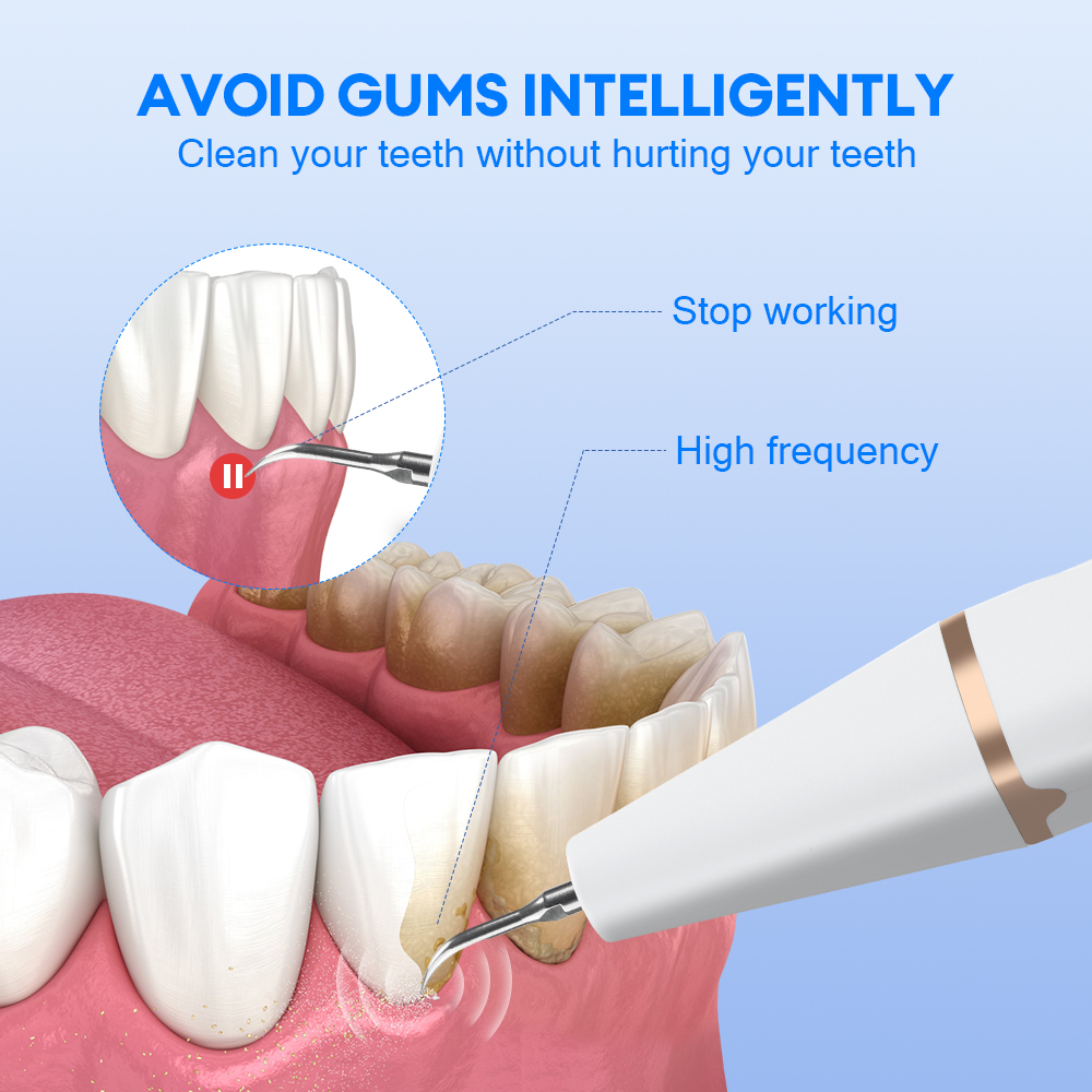 Ultrasonic Teeth Tartar Cleane - Teeth Whitening And Stain Removal ulasan dan harga