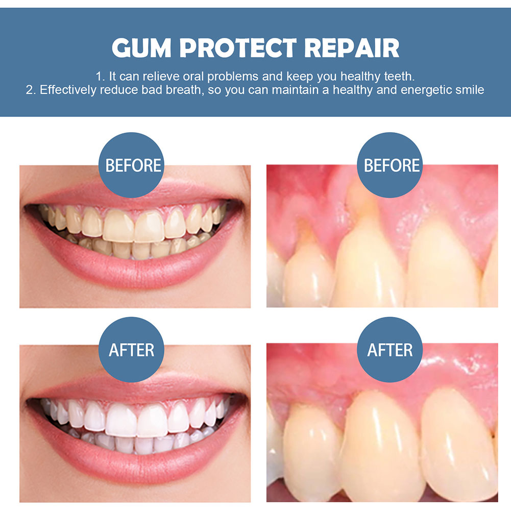 Gum Protection Repair Gel Reli - Teeth Whitening Pen ulasan dan harga
