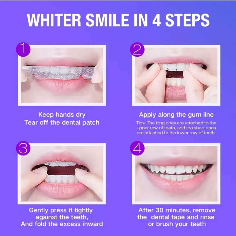 Teeth Whitening Kit - 5X LED L - Teeth Whitening With Peroxide ulasan dan harga