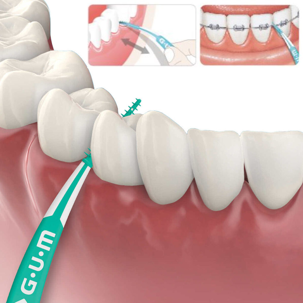Gum Soft Picks Advanced Small  - Teeth Whitening Opalescence ulasan dan harga