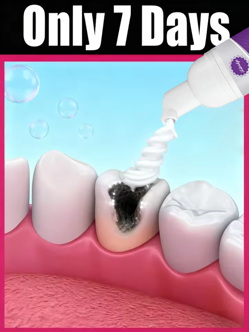 Tooth Decay Repair All Cavitie - Teeth Whitening And Stain Removal ulasan dan harga
