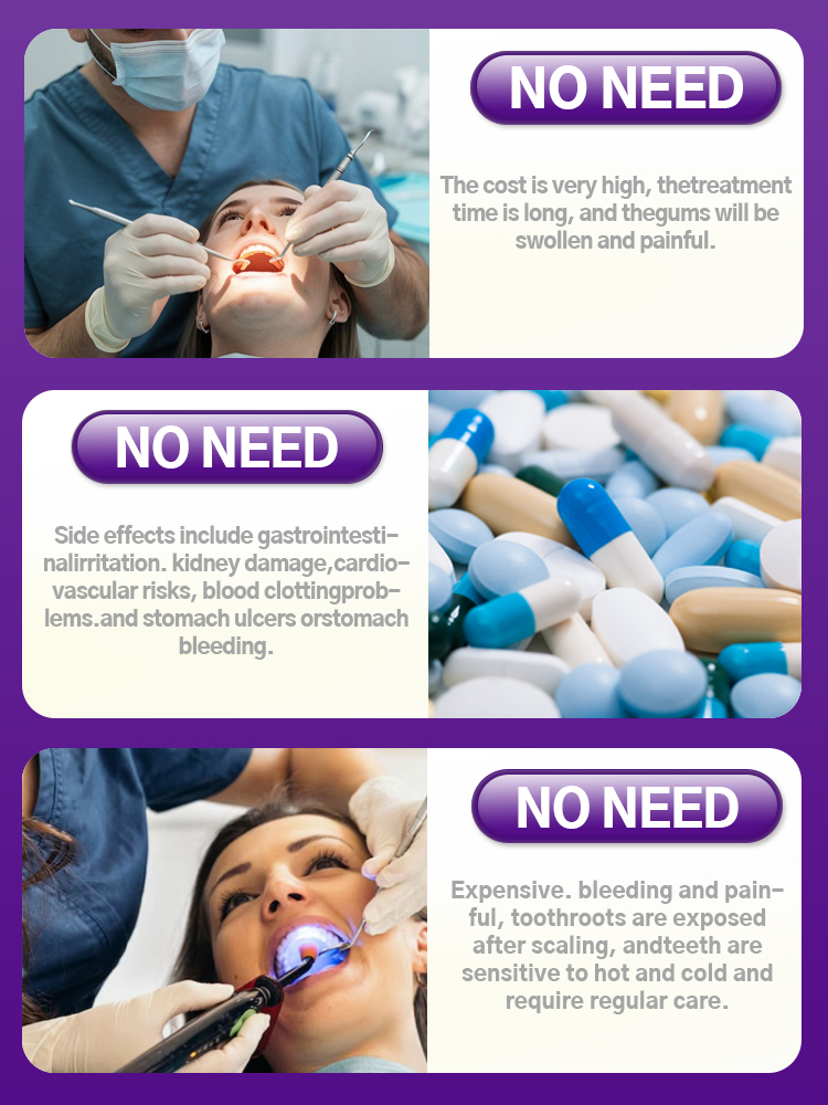 Tooth Decay Repair All Cavitie - Teeth Whitening And Stain Removal ulasan dan harga