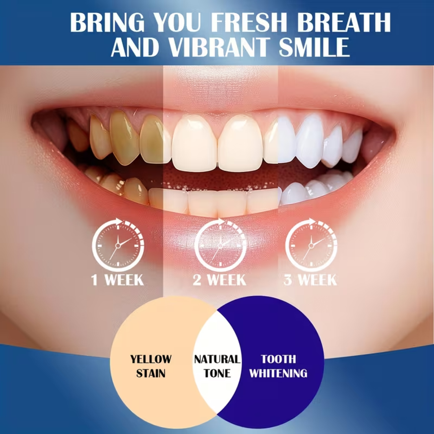 20% Hydroxyapatite Toothpaste. - Teeth Whitening Opalescence ulasan dan harga