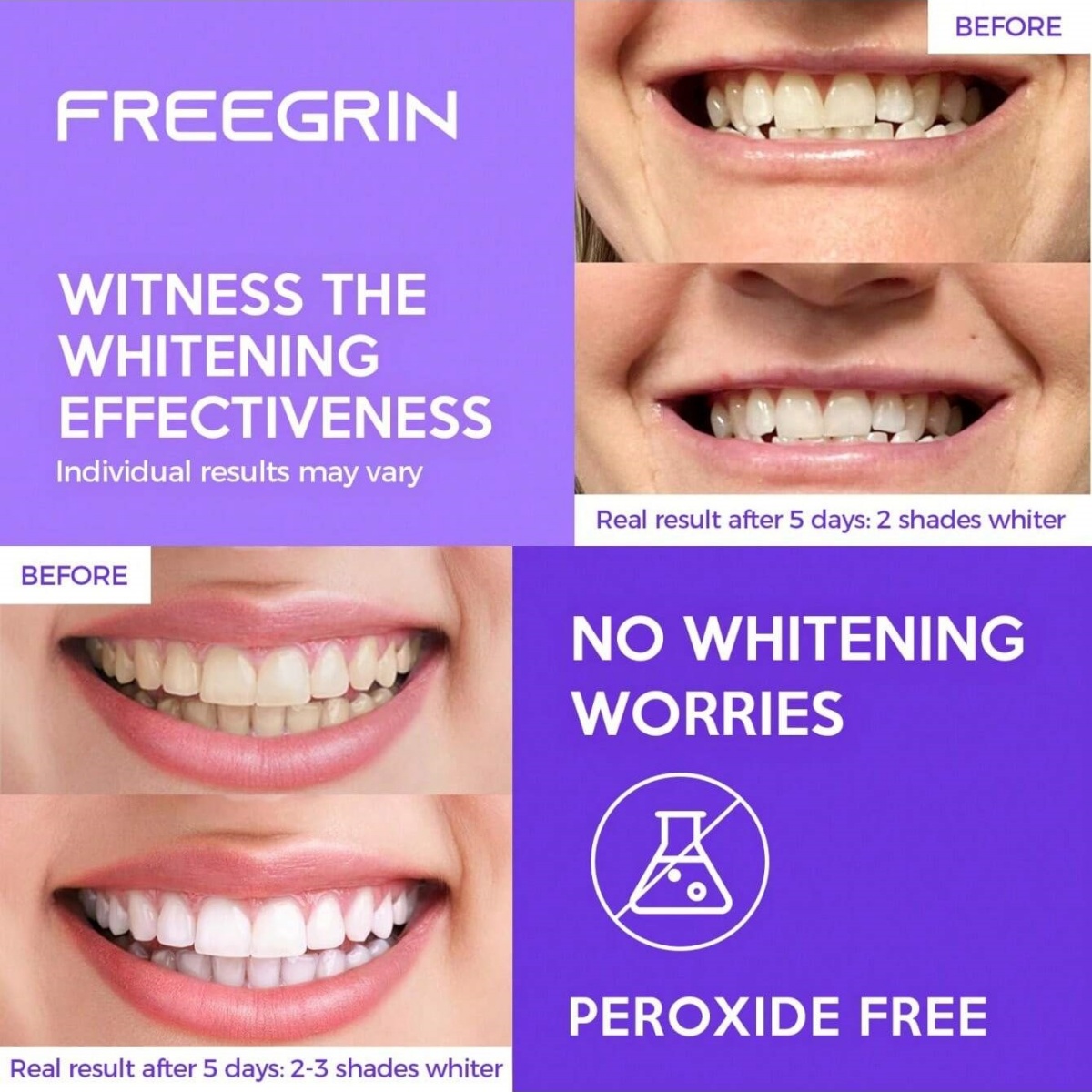 Deluxe Whitening Teeth Sticker - Teeth Whitening Remedies ulasan dan harga