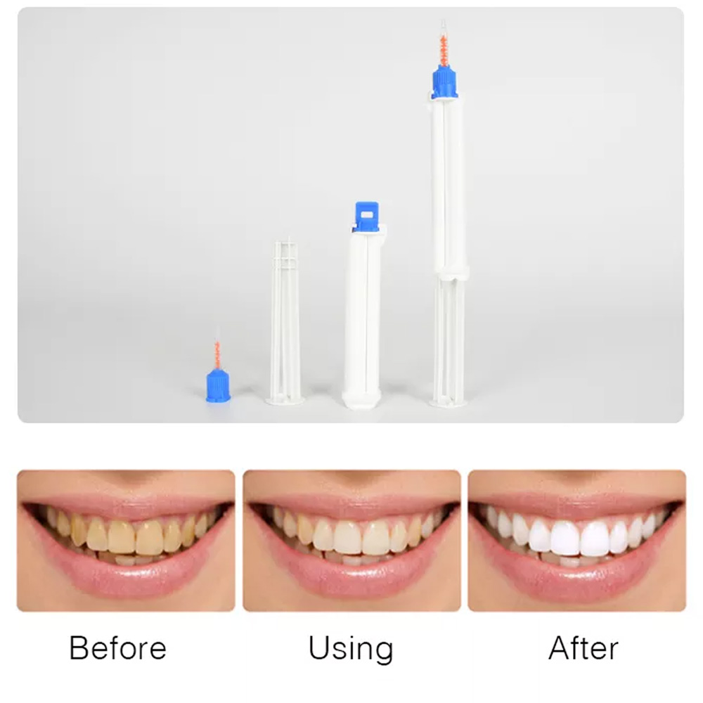 10 /5/2pcs Dental Dual Barrel  - Teeth Whitening Opalescence ulasan dan harga