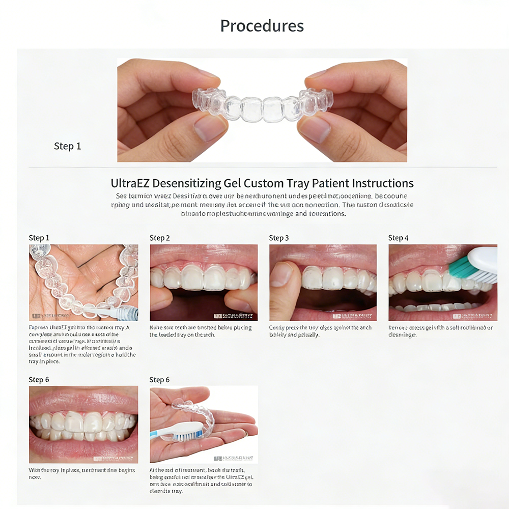 Ultra Ez Dental Desensitizing  - Teeth Whitening Opalescence ulasan dan harga