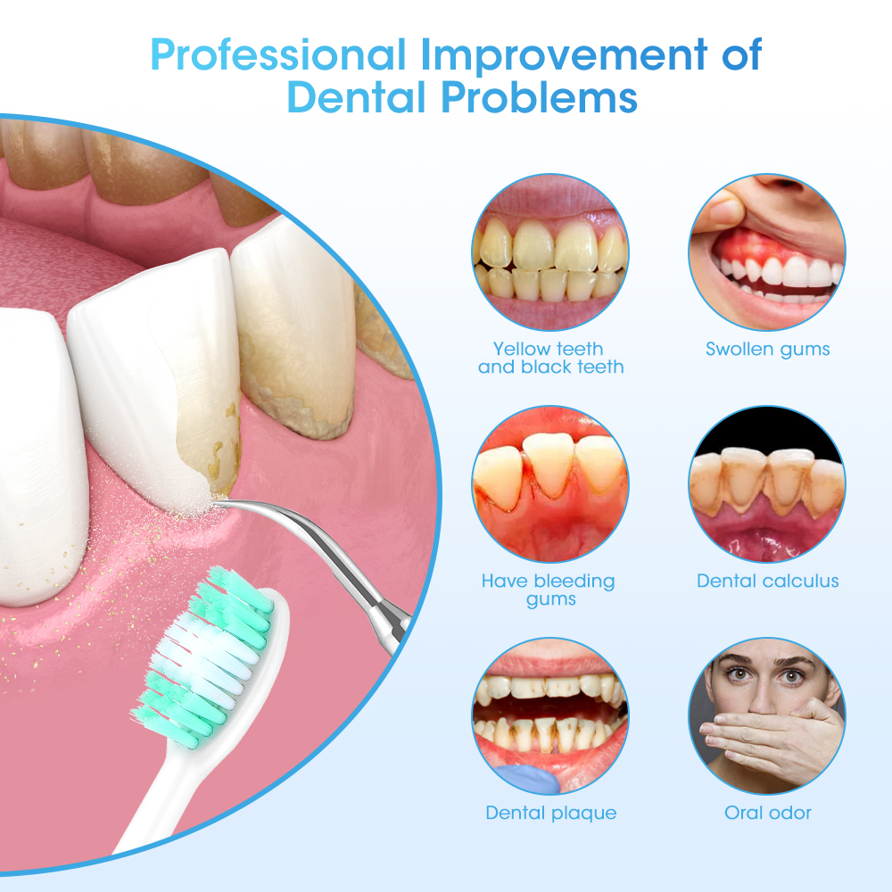 Electric Teeth Cleaner Sonic D - Teeth Whitening And Stain Removal ulasan dan harga