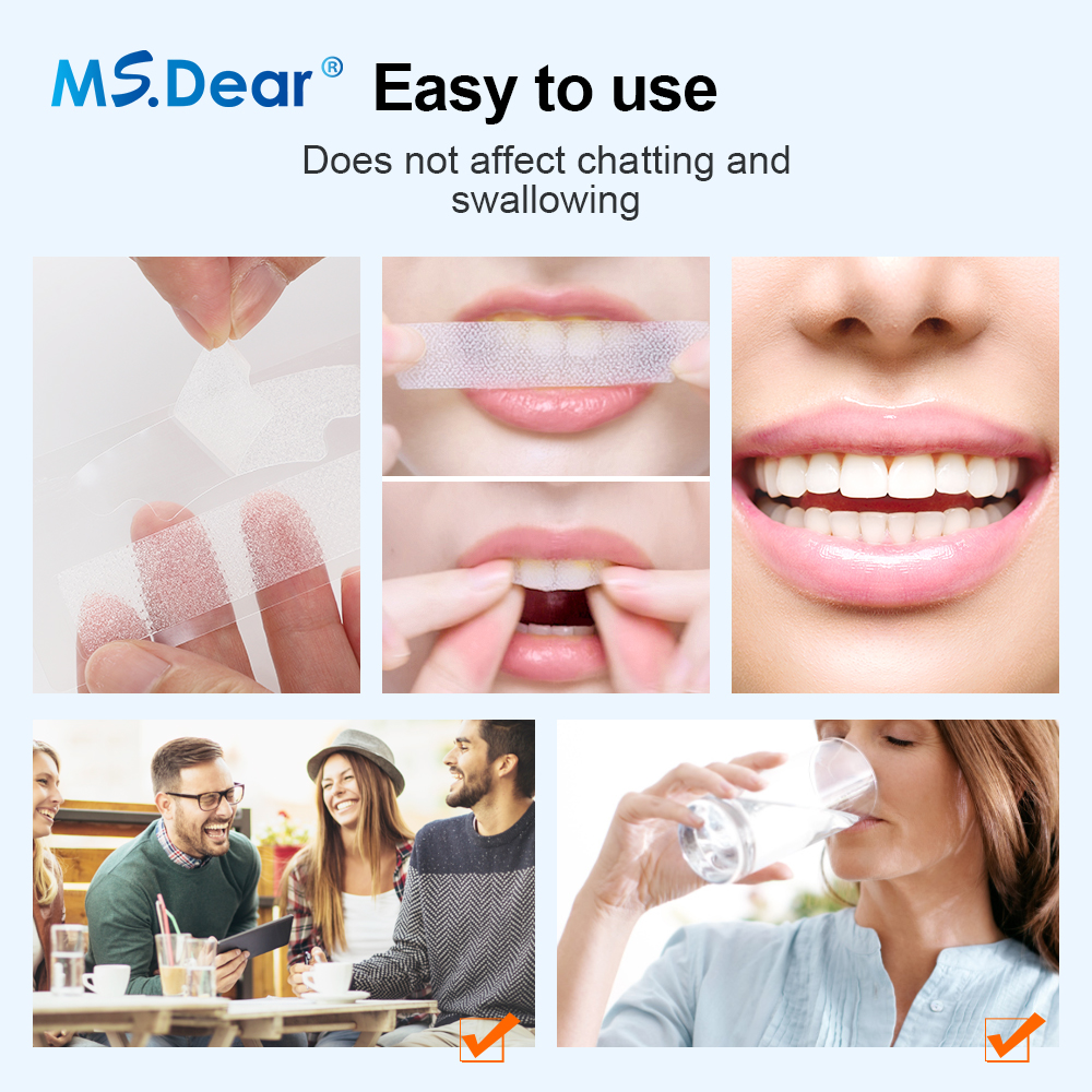 5D Whitening Teeth Stickers Wh - Teeth Whitening Effects ulasan dan harga