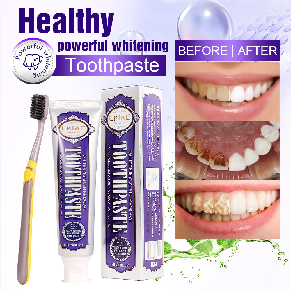 LKIAE White Teeth Whitening To - Teeth Whitening And Stain Removal ulasan dan harga