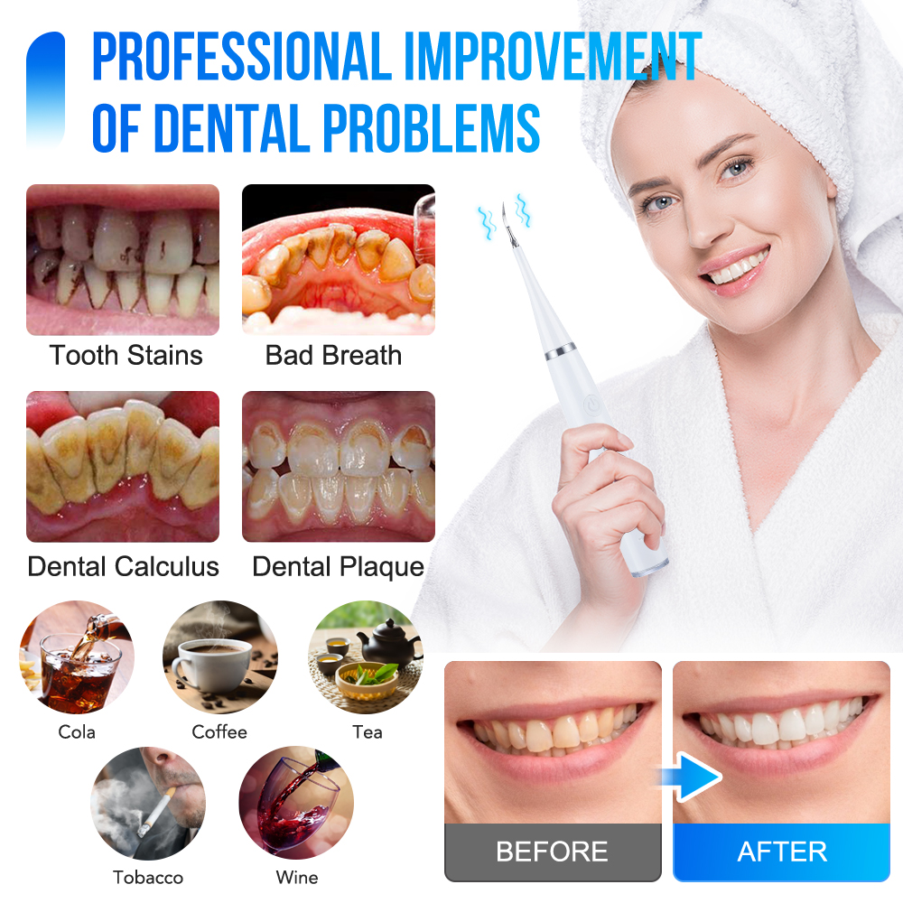 Household Electric Teeth Clean - Teeth Whitening And Stain Removal ulasan dan harga